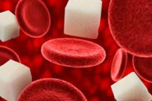 Kan şekerindeki artış birçok faktörden kaynaklanır. 